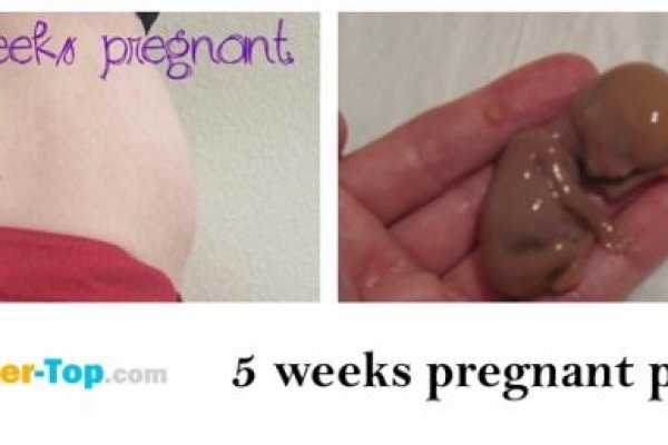 Kraken зеркало даркнет